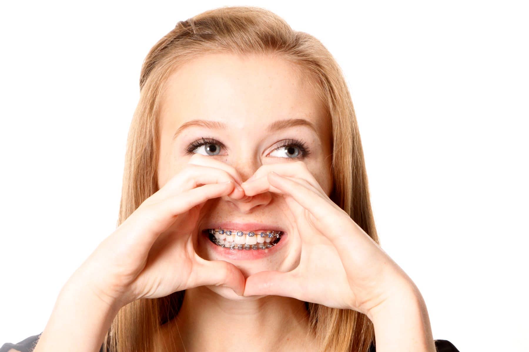 Sonrisa con brackets estéticos cerca de Chamartín