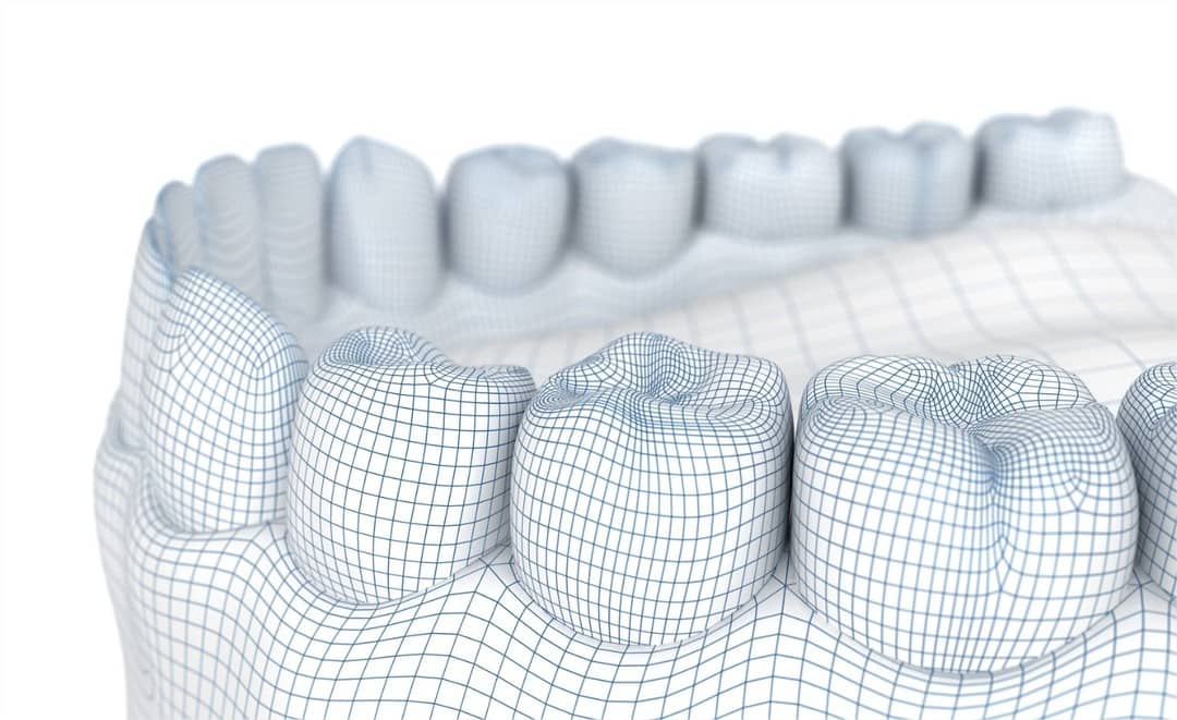 Sonrisa y férula dental para explicar precio de férula de descarga