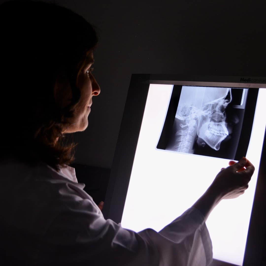 Radiografía dental revisada antes de aceptar un presupuesto de implantes