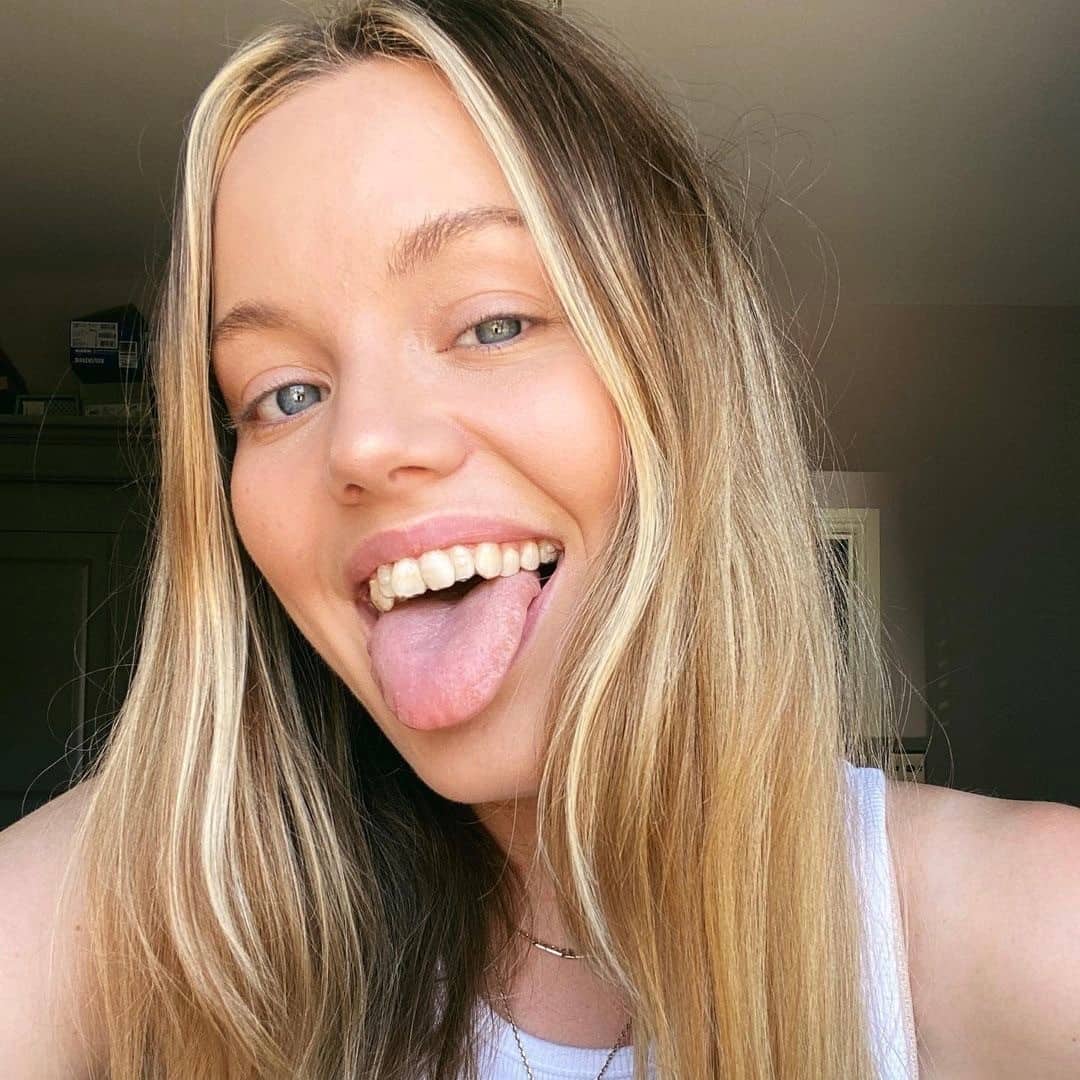 Alineadores transparentes para valorar Invisalign Teen en adolescentes