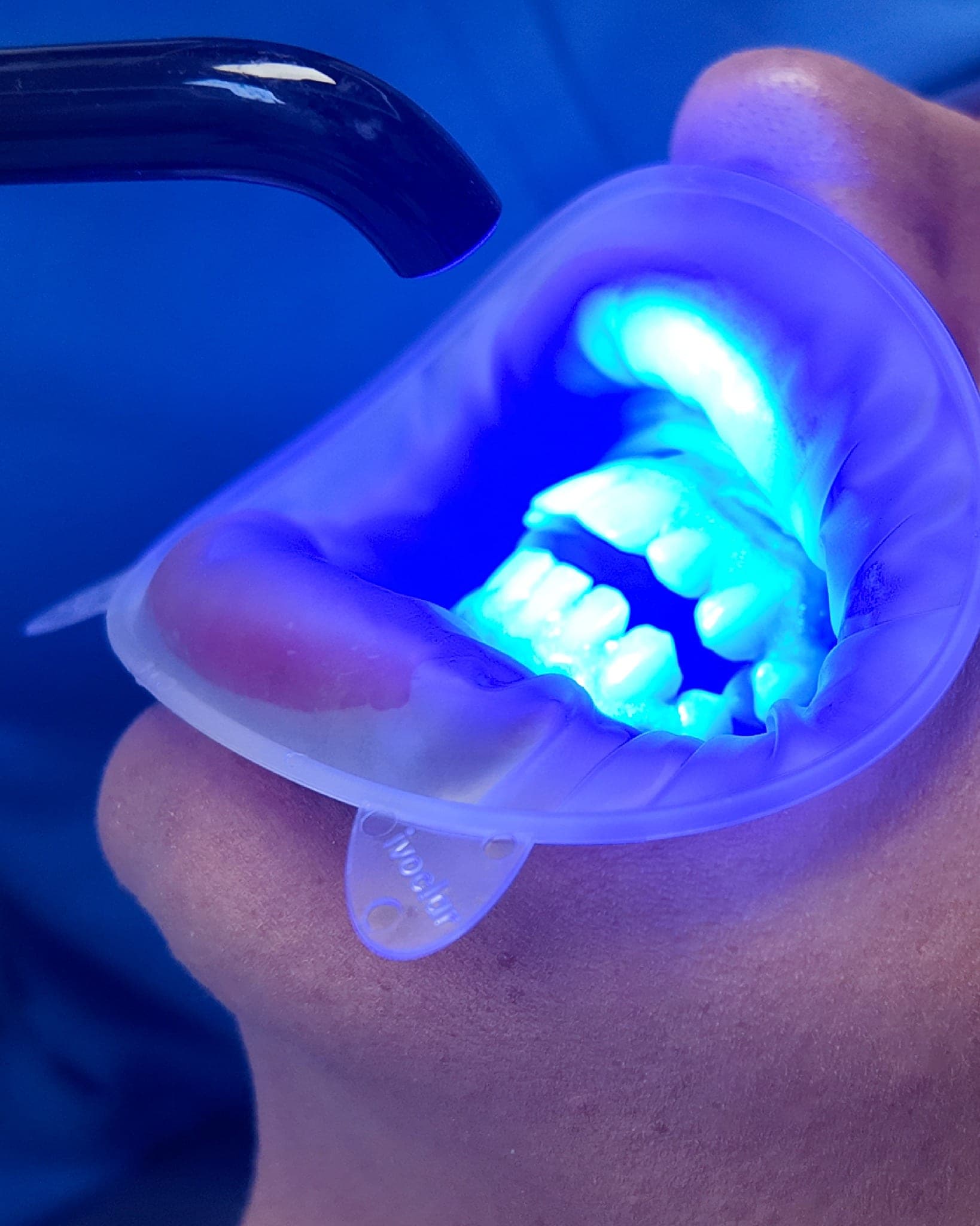 Detalle de blanqueamiento dental LED para valorar color