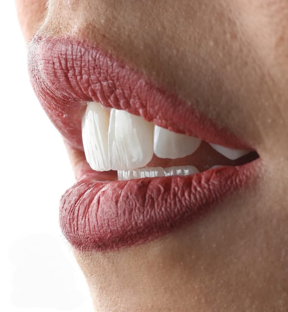 Detalle de dientes y labios para valorar textura, forma y proporción en diseño de sonrisa