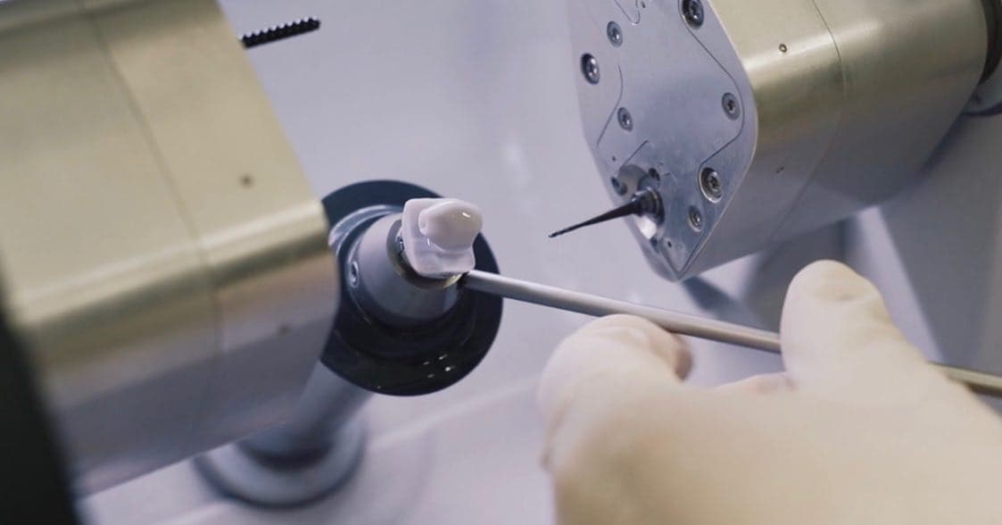 Corona dental diseñada digitalmente para planificar una rehabilitación con implantes