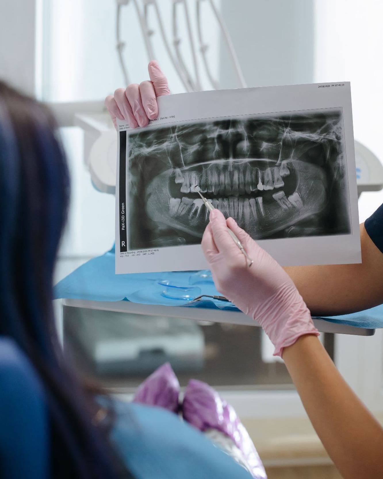 Radiografía dental revisada antes de planificar implantes dentales