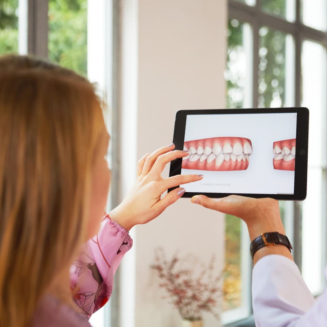 Planificación digital de Invisalign antes de explicar el presupuesto