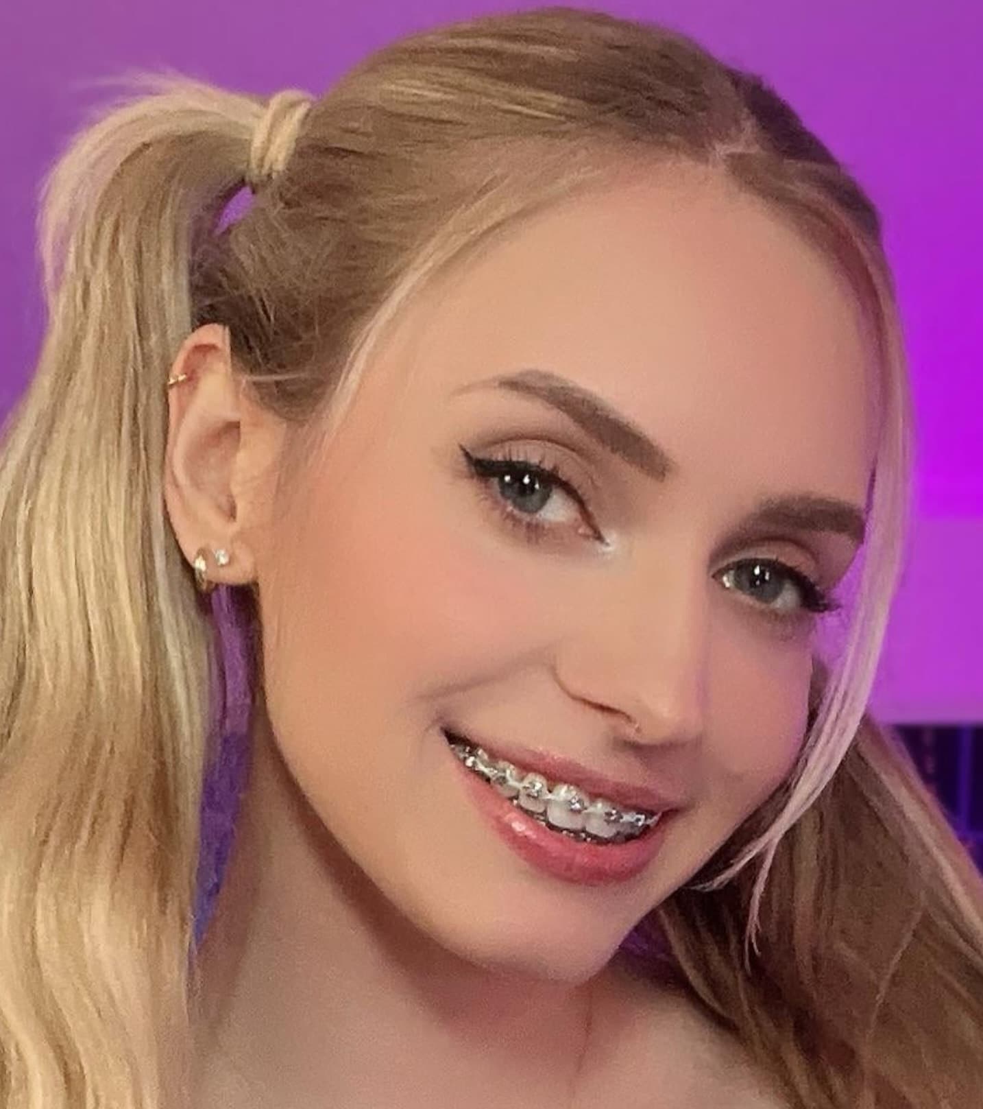 Paciente con brackets durante una valoración de ortodoncia fija