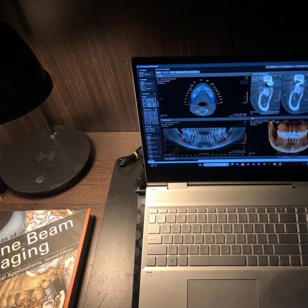 Planificación CBCT para valorar mandíbula, mordida y estructura antes de decidir cirugía ortognática