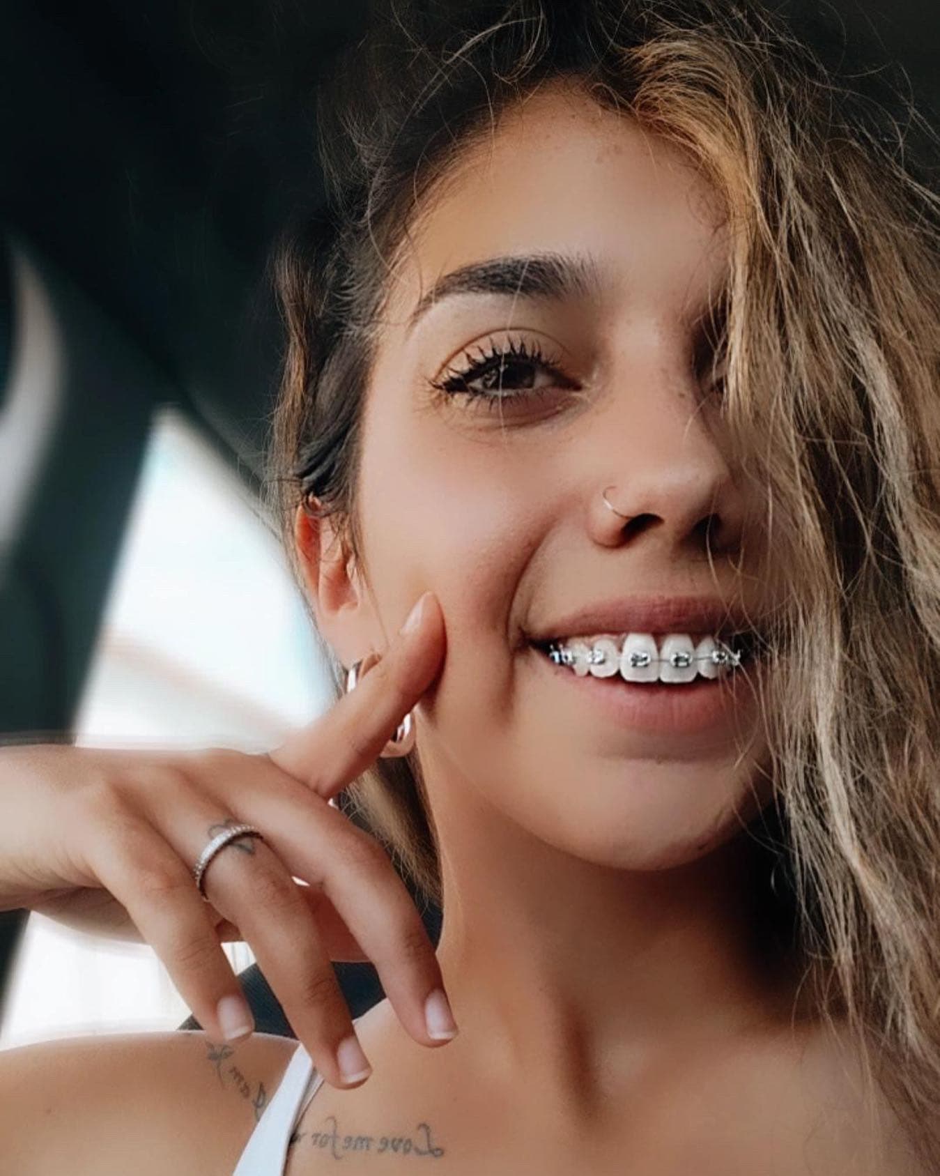 Paciente con brackets sonriendo durante su rutina de ortodoncia