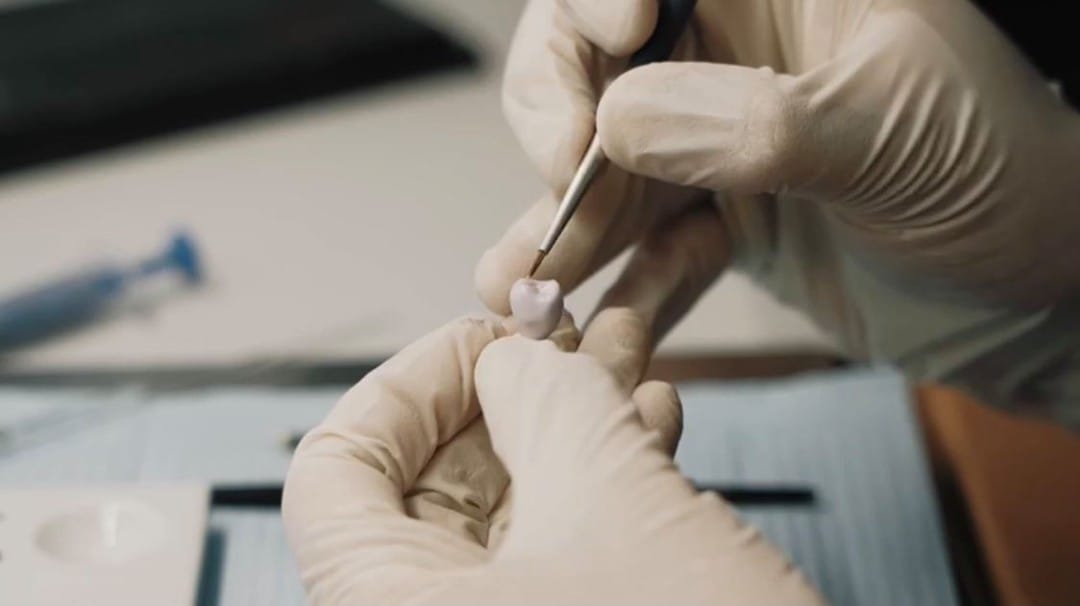 Material clínico preparado para valorar cirugía oral con precisión