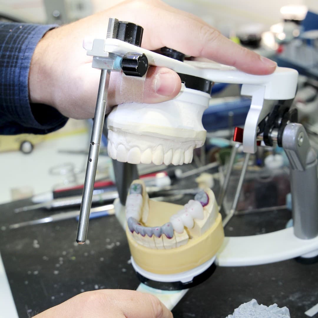 Articulador dental para ajustar mordida en prótesis